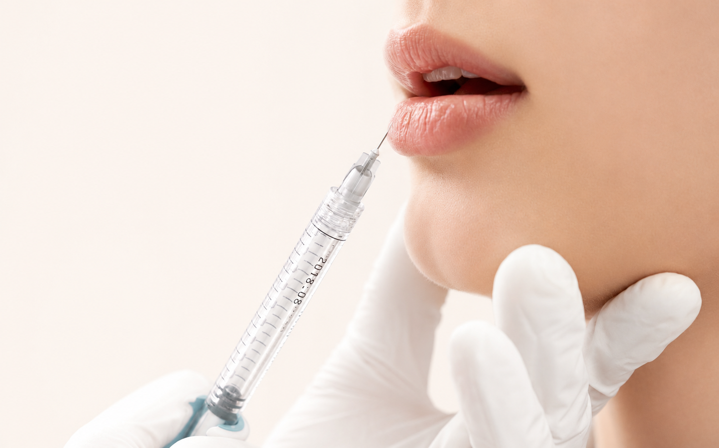 然轮廓塑形+唇部精雕(Filler+Lip Enhancement)